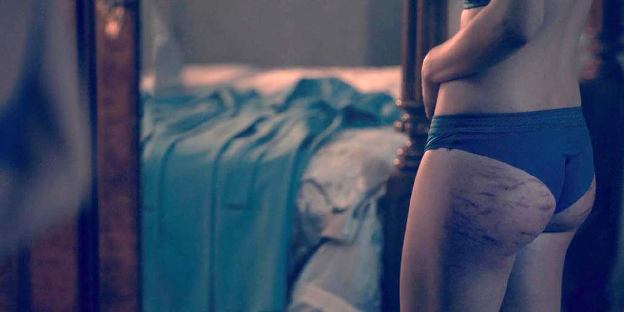 Yvonne Strahovski Ass Bruises Scene from 'The Handmaid’s Tale' .