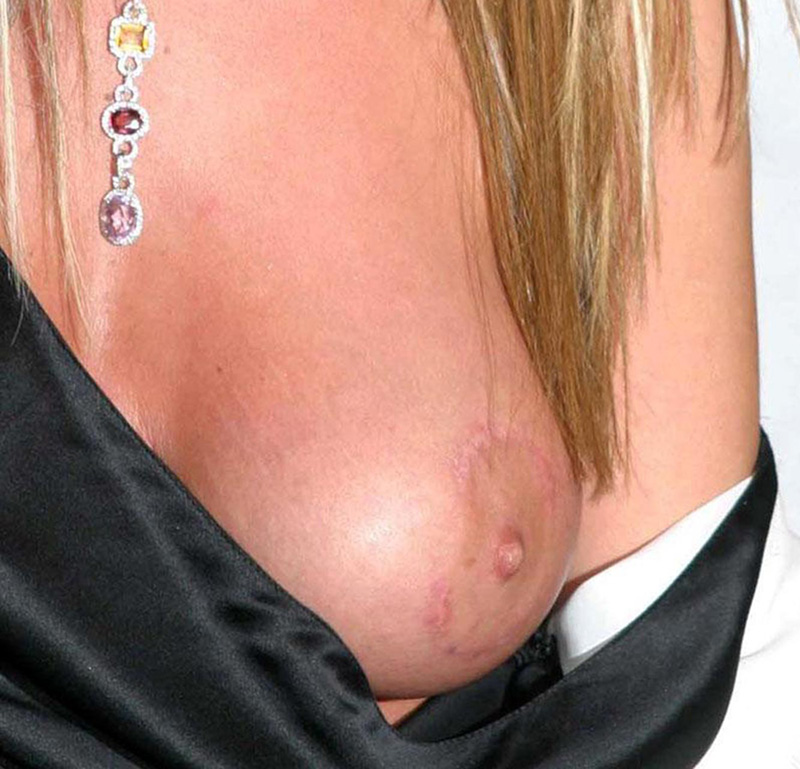 Tara Reid Nude Tit Slipped - One Of The Worst Sights Ever.