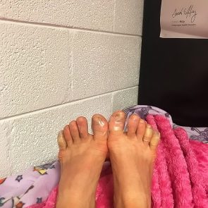 Chrissy Teigen feet hurt