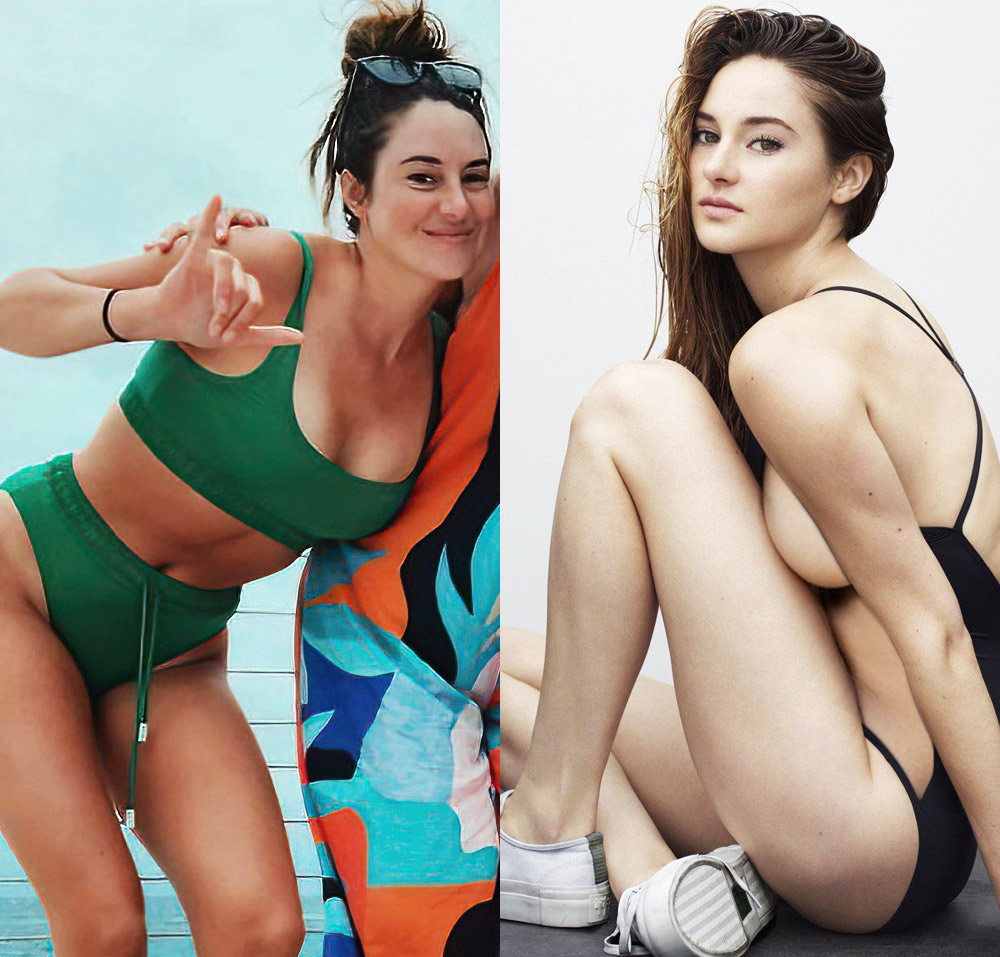 Shailene Woodley Illness